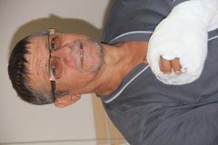 PARMAKLARINI KAYBETMEKTEN KURTULDU