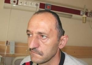 Yapay kafatası ile hayata döndü