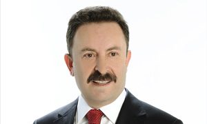Opr. Dr. Yener Yıldırım Anjiyo oldu